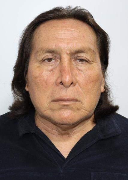Jose Levis Picon Saguma